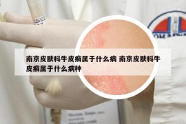 南京皮肤科牛皮癣属于什么病 南京皮肤科牛皮癣属于什么病种