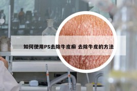 如何使用PS去除牛皮癣 去除牛皮的方法