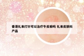 香港礼来打针可以治疗牛皮癣吗 礼来皮肤科产品