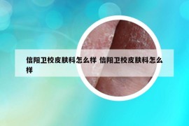 信阳卫校皮肤科怎么样 信阳卫校皮肤科怎么样