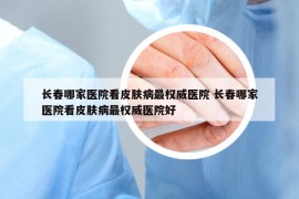 长春哪家医院看皮肤病最权威医院 长春哪家医院看皮肤病最权威医院好