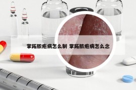 掌跖脓疱病怎么制 掌跖脓疱病怎么念