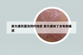 肤力康抗菌洗剂灼烧感 肤力康抹了会有刺痛感