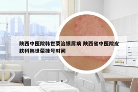陕西中医院韩世荣治银屑病 陕西省中医院皮肤科韩世荣挂号时间