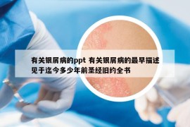 有关银屑病的ppt 有关银屑病的最早描述见于迄今多少年前圣经旧约全书