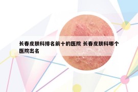 长春皮肤科排名前十的医院 长春皮肤科哪个医院出名