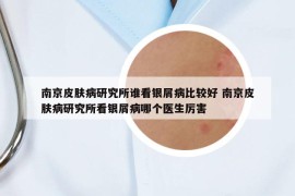 南京皮肤病研究所谁看银屑病比较好 南京皮肤病研究所看银屑病哪个医生厉害
