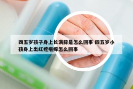 四五岁孩子身上长满藓是怎么回事 四五岁小孩身上出红疙瘩痒怎么回事