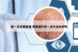 就一点点银屑病 银屑病只有一点不治会好吗