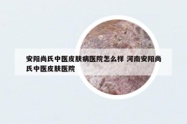 安阳尚氏中医皮肤病医院怎么样 河南安阳尚氏中医皮肤医院