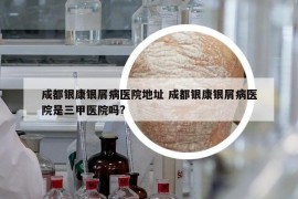 成都银康银屑病医院地址 成都银康银屑病医院是三甲医院吗?