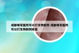 成都哪家医院可以打生物制剂 成都哪家医院可以打生物制剂疫苗