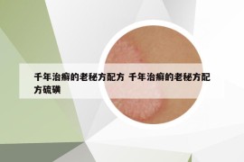 千年治癣的老秘方配方 千年治癣的老秘方配方硫磺
