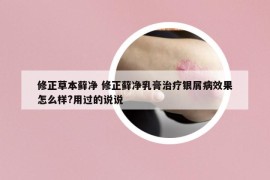 修正草本藓净 修正藓净乳膏治疗银屑病效果怎么样?用过的说说