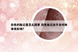 白色的胎记是怎么回事 白色胎记会不会对身体有影响?