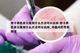 脖子黑色素沉着用什么方法可以去掉 脖子黑色素沉着用什么方法可以去掉_寻医问药专家频道