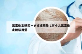 氯雷他定糖浆一岁宝宝用量 1岁小儿氯雷他定糖浆用量