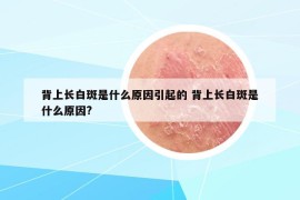 背上长白斑是什么原因引起的 背上长白斑是什么原因?