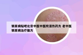 银屑病贴吧北京中医中医院湿热药方 老中医银屑病治疗偏方
