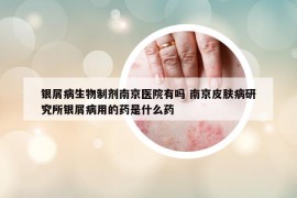 银屑病生物制剂南京医院有吗 南京皮肤病研究所银屑病用的药是什么药