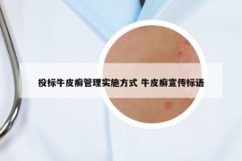 投标牛皮癣管理实施方式 牛皮癣宣传标语