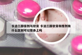 卡泊三醇搽剂与软膏 卡泊三醇软膏和擦剂有什么区别可以擦身上吗