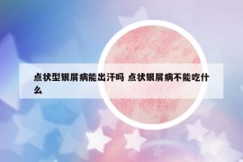 点状型银屑病能出汗吗 点状银屑病不能吃什么