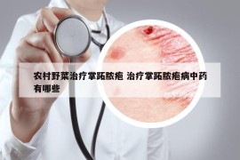 农村野菜治疗掌跖脓疱 治疗掌跖脓疱病中药有哪些