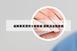麻黄黄芪薄荷十银屑病 麻黄汤治银屑病