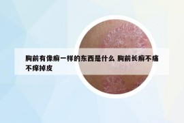 胸前有像癣一样的东西是什么 胸前长癣不痛不痒掉皮