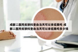 成都二医院皮肤科查血当天可以拿结果吗 成都二医院皮肤科查血当天可以拿结果吗多少钱