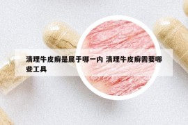 清理牛皮癣是属于哪一内 清理牛皮癣需要哪些工具