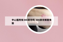 中心医院有308激光吗 308激光哪里有做