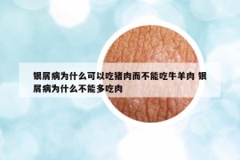 银屑病为什么可以吃猪肉而不能吃牛羊肉 银屑病为什么不能多吃肉