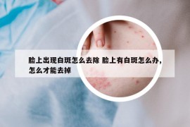 脸上出现白斑怎么去除 脸上有白斑怎么办,怎么才能去掉