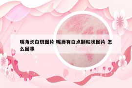 嘴角长白斑图片 嘴唇有白点颗粒状图片 怎么回事