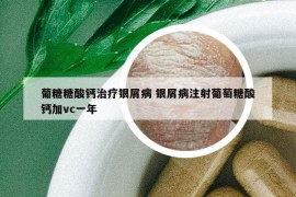 葡糖糖酸钙治疗银屑病 银屑病注射葡萄糖酸钙加vc一年