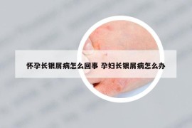 怀孕长银屑病怎么回事 孕妇长银屑病怎么办