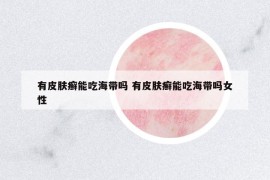 有皮肤癣能吃海带吗 有皮肤癣能吃海带吗女性