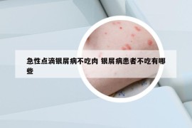 急性点滴银屑病不吃肉 银屑病患者不吃有哪些