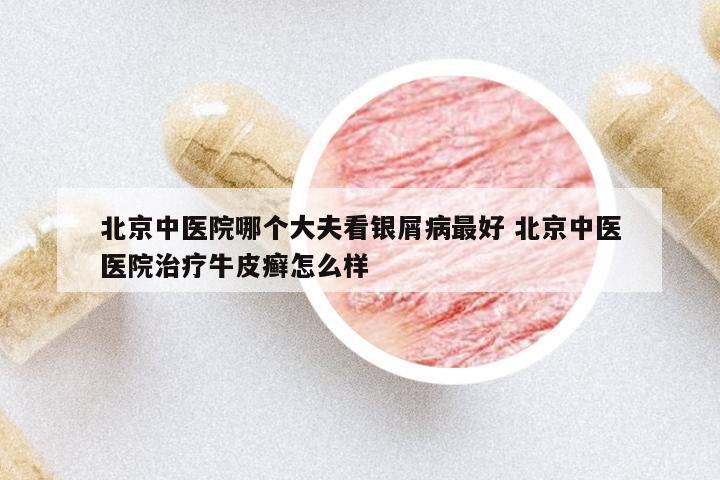 北京中医院哪个大夫看银屑病最好 北京中医医院治疗牛皮癣怎么样