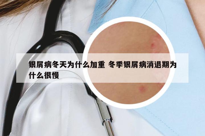 银屑病冬天为什么加重 冬季银屑病消退期为什么很慢