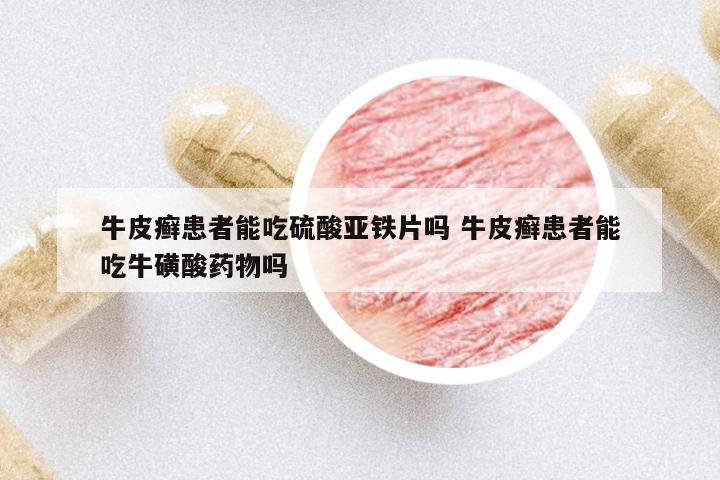 牛皮癣患者能吃硫酸亚铁片吗 牛皮癣患者能吃牛磺酸药物吗