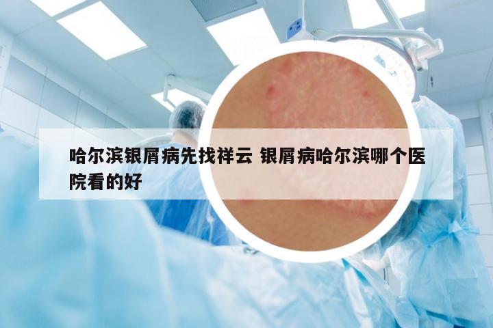 哈尔滨银屑病先找祥云 银屑病哈尔滨哪个医院看的好