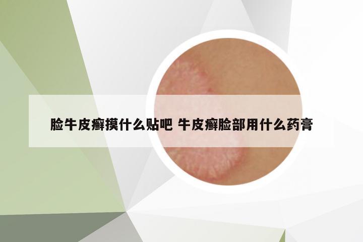 脸牛皮癣摸什么贴吧 牛皮癣脸部用什么药膏
