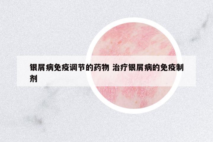 银屑病免疫调节的药物 治疗银屑病的免疫制剂